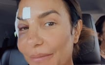 Boletim de Saúde | com olho roxo, Ivete recebe alta de hospital em Salvador e explica quadro de saúde