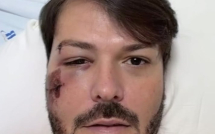 Acidente de Bicicleta | prefeito de Encruzilhada sofre queda e está hospitalizado em Vitória da Conquista