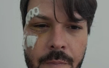 Boletim de Saúde | prefeito de Encruzilhada recebe alta hospitalar e cumpre repouso em Vitória da Conquista