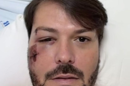 Acidente de Bicicleta | prefeito de Encruzilhada sofre queda e está hospitalizado em Vitória da Conquista